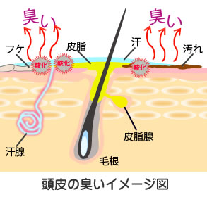 頭皮の臭いイメージ図