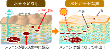 しみ肌の原因