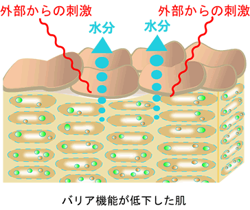 低下肌のイメージ